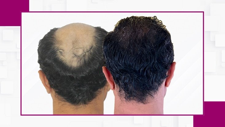 Before-After1