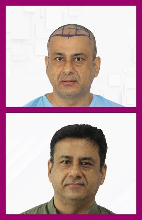 f3a939e7-ddb4-4abf-b8cc-f8baa97ad25b